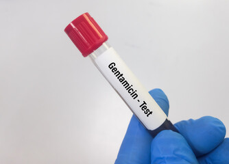 Blood sample for Gentamicin level test, drug therapy and monitor patient adherence.