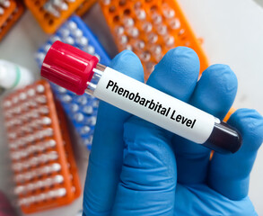 Blood sample for Phenobarbital test, used to measure and monitor the amount of phenobarbital in the...