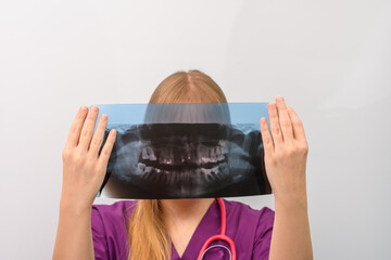 Lekarz dentysta trzyma w dłoniach prześwietlenie zębów, zdjecie pantomogram rtg - obrazy, fototapety, plakaty