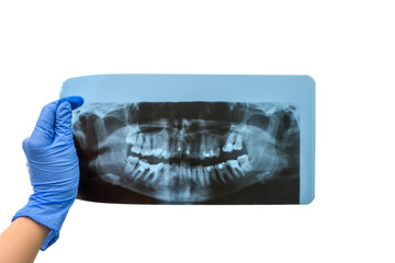 Dentysta trzyma w dłoni pantomogram panoramiczne zdjęcie zębów  - obrazy, fototapety, plakaty