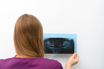 Lekarz stomatolog trzyma w ręku zdjecie prześwietlenie rtg pantomogram szczęki  - obrazy, fototapety, plakaty
