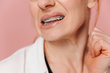 Close-up woman suffering from pain due to braces on pink background