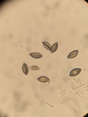 photo of date palm pollen powder under the microscope