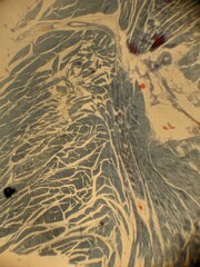 microscope slide contain section of human tissue