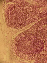 photo of section of human tissue under the microsocope 