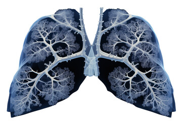 A lung radiograph of a non-smoker shows normal-appearing lungs. Without the gender of cancer or symptoms that promote lung cancer Isolated on a transparent background.