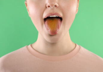 Gastrointestinal diseases. Woman showing her yellow tongue on green background, closeup