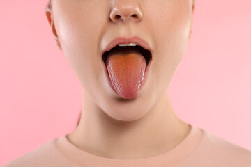 Gastrointestinal diseases. Woman showing her yellow tongue on pink background, closeup