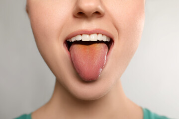 Gastrointestinal diseases. Woman showing her yellow tongue on white background, closeup