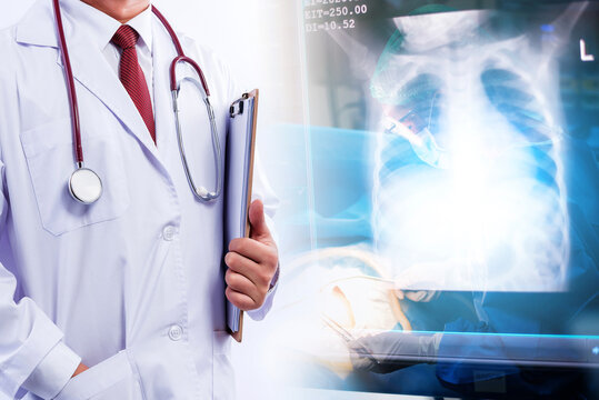 Doctor in lab coat with stethoscope with lung  X-ray film on white background