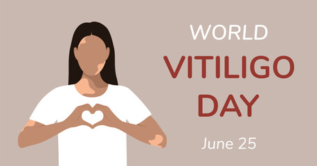 Postcard, poster in flat style. June 25 is World Vitiligo Day. Woman in white t-shirt, heart-shaped hands, skin with lost pigment. Vector illustration EPS10