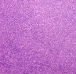 Cervical lymph node(biopsy): Non-Hodgkin's lymphoma-high grade. Light microscopically show monotonous population of atypical lymphoid cells. Malignant tumor.
