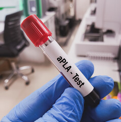 Blood Sample tube for APLA (Anti phospholipid antibodies) test, to diagnosis of Antiphospholipid...