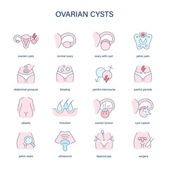Ovarian Cysts symptoms, diagnostic and treatment vector icons. Medical icons. - 760794601