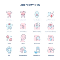 Adenomyosis symptoms, diagnostic and treatment vector icons. Medical icons. - 760794637