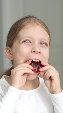 Large children's teeth with a dental plate. Braces system on teeth. Alignment of teeth using a dental plate. Malocclusion in a child. Crooked teeth. The concept of pediatric dentistry.