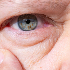 close-up mature woman's eye, revealing natural signs aging such wrinkles and puffiness under lower...