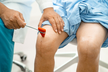 Asian doctor use hammer knock senior woman patient to check knee reflex, nerve and muscle in...