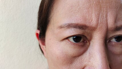 portrait showing the wrinkle and Flabby skin, forehead lines, ptosis and swelling on the face of the woman, health care and beauty concept  - obrazy, fototapety, plakaty