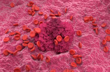 Fototapeta premium Red cells and fibrin coagulum - isometric view 3d illustration
