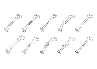 Bone fracture line icons set. Vector isolated element.