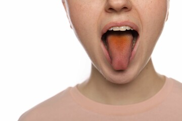 Gastrointestinal diseases. Woman showing her yellow tongue on white background, closeup