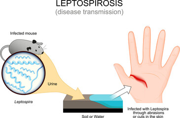 Leptospirosis. Disease transmission from Infected mouse.