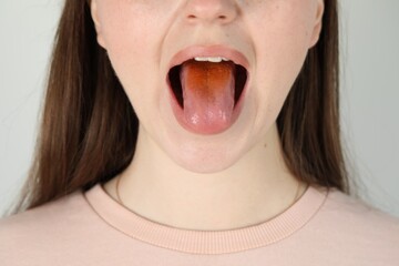 Gastrointestinal diseases. Woman showing her yellow tongue on light grey background, closeup