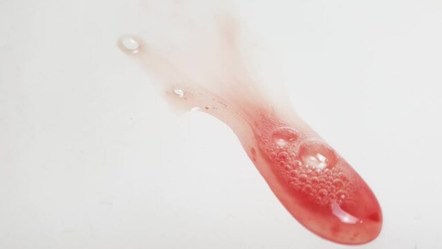 Hemoptysis. Saliva with blood from the bathroom sink.