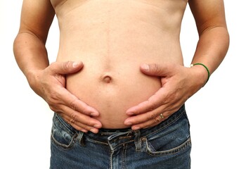 Naklejka premium person in jeans, Man is belly. Wearing a blue jeans. There is a lot of excess fat. Fat groove until the belly sags, Overweight, Holding both hands, Dimpled navel and loss weight with healthy concept