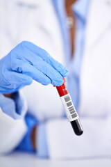 Scientist, hands and blood test in laboratory for research of DNA, virus and analysis or medical...