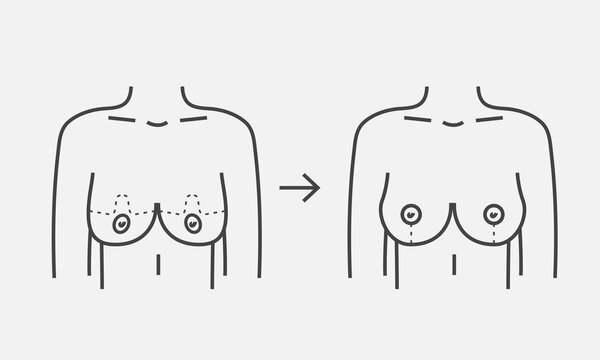 Correction female breast line icon. Plastic surgery procedure. Vector illustration