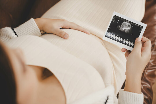 An expectant mother holding an ultrasound scan of her unborn baby, a special moment of connection.
