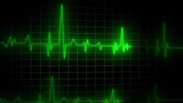 Neon Electrocardiogram Heartbeat Pulse Heart attack monitoring Medical Patient Treatment Display Background Loop.