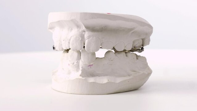 Closeup kid orthodontic dental impression chalk model rotating on white backgrou