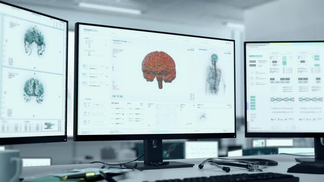 Molecular research of the human organs at the medical laboratory. Researching the molecular structure of the brain organ affected by cancer. Molecular research of the tumor infecting the vital organ.