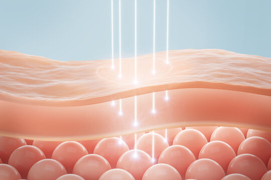 Laser shot through Saggy skin cell layer, skin and Facial treatment. 3D rendering.
