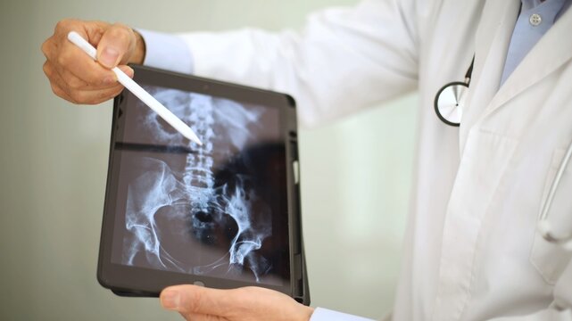 Doctor analyzing spine X-ray on tablet, highlighting diagnostic radiology.