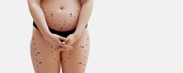 Female body with the drawing arrows. Fat lose, liposuction and cellulite removal concept. Beauty...
