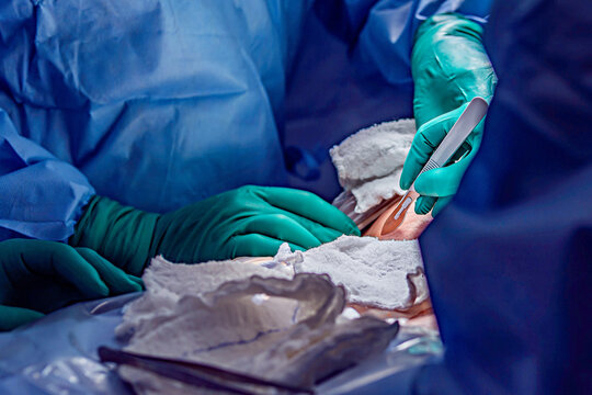 Corte com bisturi na cirurgia de parto para nascimento do feto beb&ecirc; rec&eacute;m-nascido