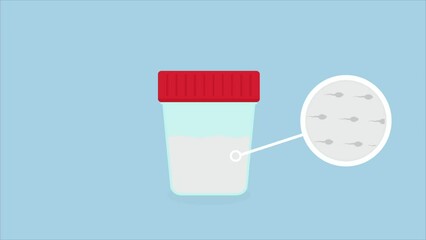 semen sperm test sample. Reproductive health check