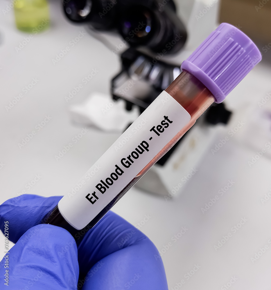 Canvas Prints Technician hold blood sample for Er Blood Group System.