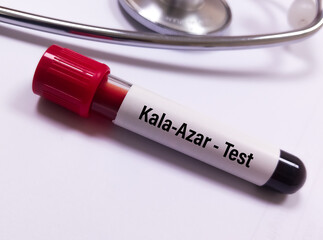 Blood sample for Kala-azar test with laboratory background. Visceral leishmaniasis (VL).