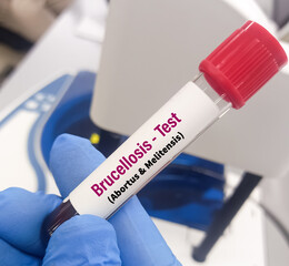 Blood sample for Triple antigen test, diagnosis of salmonellosis, brucellosis and rickettsia diseases. Febrile antigen test.