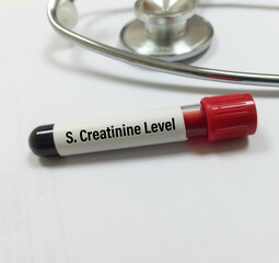 Blood sample for Serum Creatinine test. Diagnosis of kidney or renal disease.