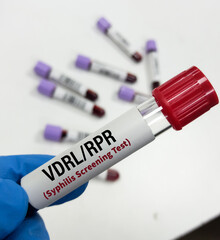 Naklejka premium Blood sample for VDRL or RPR test, Syphilis screening test. To diagnosis Syphilis and Gonorrhea, STD disease.