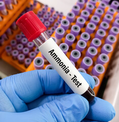 Fototapeta premium Blood sample for Ammonia test to diagnosis of ammonia levels also known as hyperammonemia. urea cycle deficiencies.