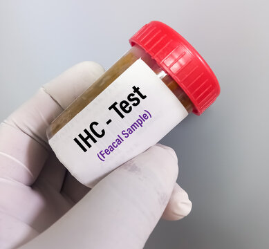 Stool Immunohistochemistry (IHC) Test, This test involves staining a types of cancer, such as colorectal cancer.