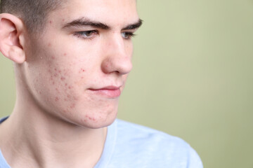 Obraz premium Young man with acne problem on olive background, closeup