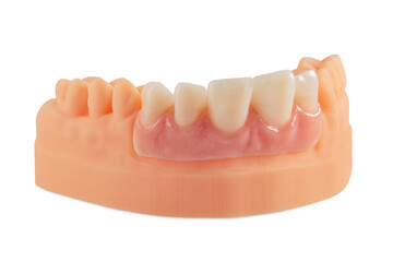 Denture on artificial silicone gum. Dental model of teeth isolated on a white background.